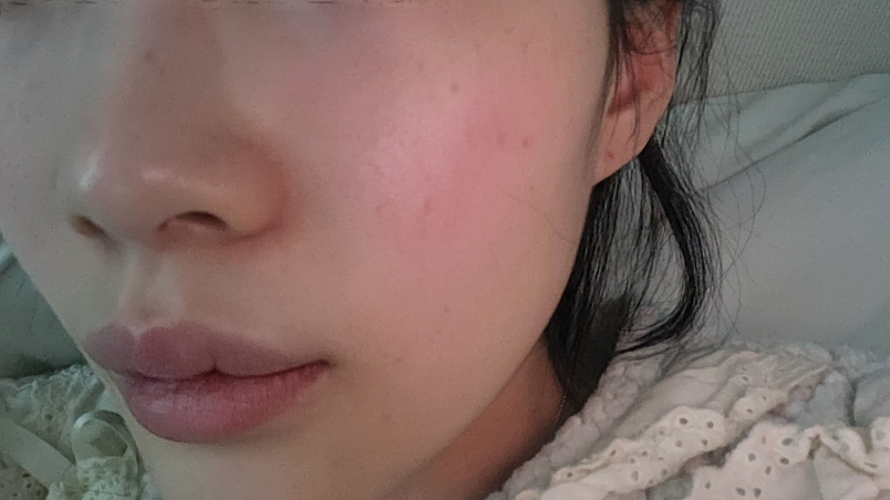 天然发酵山茶眼霜的真实用户使用照片