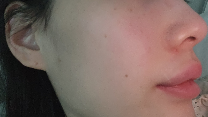 AMPLE:N Hyaluron Shot Ampoule review image