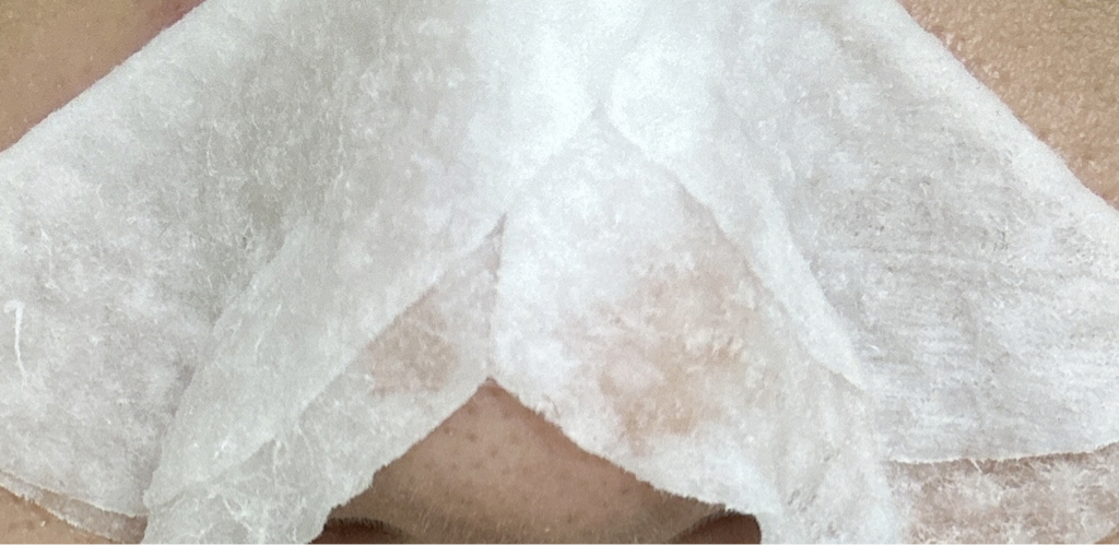 케어존 (CAREZONE) 아큐어 각질 클리어 토너 패드 review image