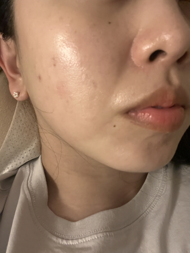 生物调理精华 水润增强面膜的真实用户使用照片