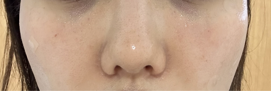 코르테 (CORTHE) 더모 레쥬비네이션 리젤 review image