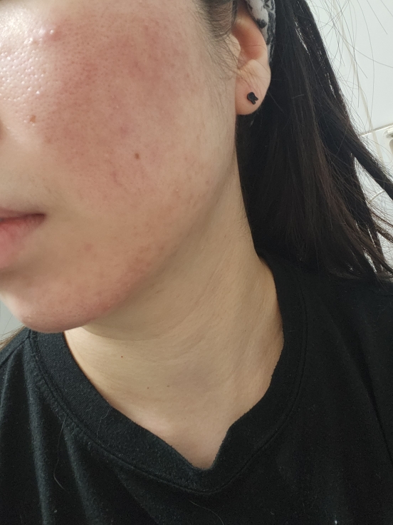 菲克斯温柔隔离霜 [SPF30/PA+++] [21号象牙色]的真实用户使用照片