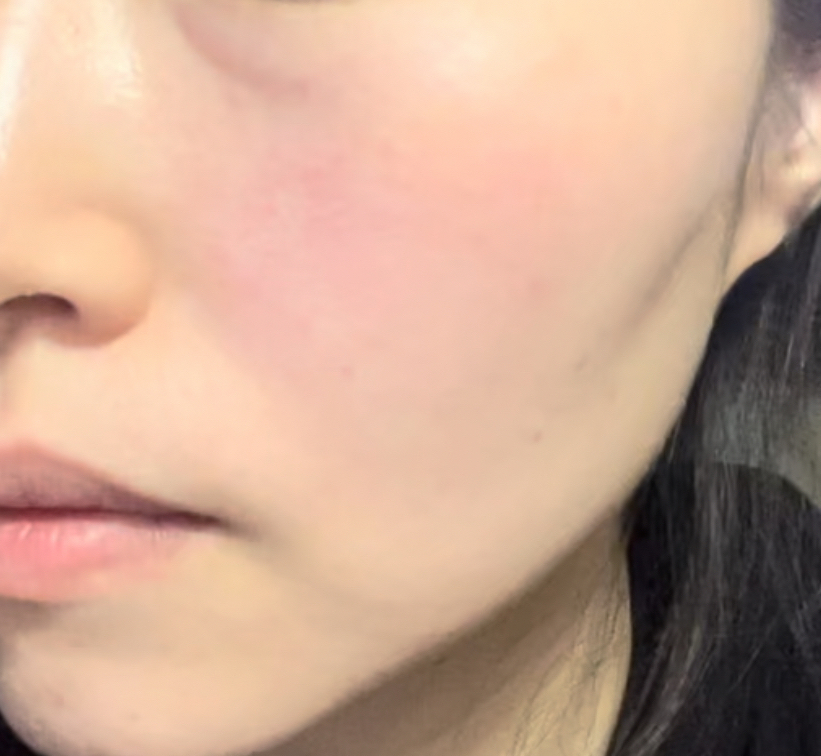 지샌달 (Jysandal) 세라믹 슬릭 15데이즈 리터닝 앰플 프로그램 review image