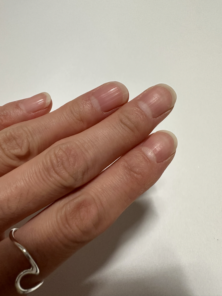 OPI (오피아이) 영양제 엔비 review image
