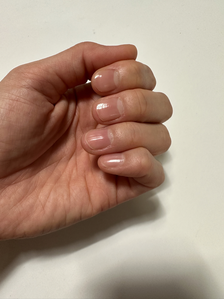 OPI (오피아이) 영양제 엔비 review image