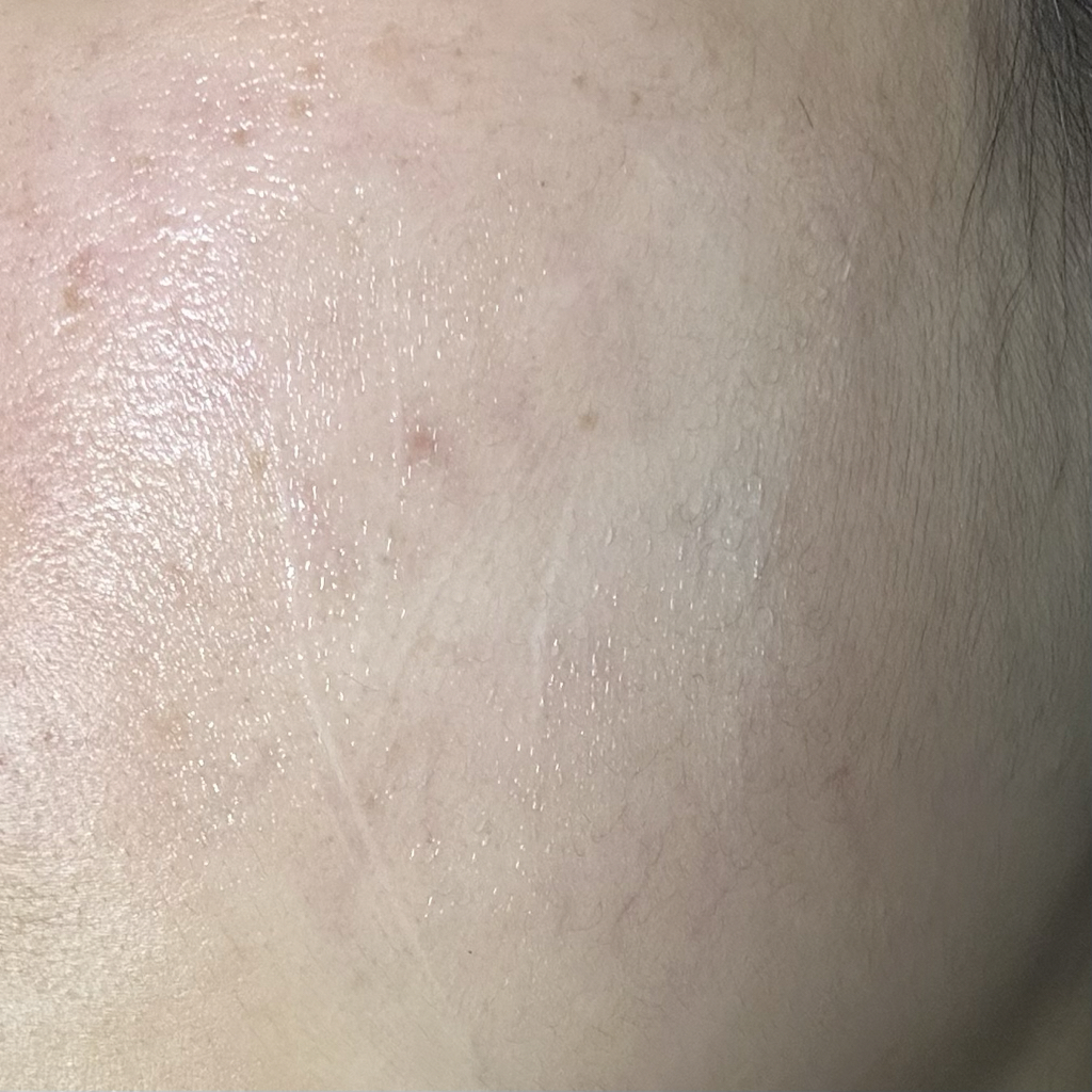 玛德赛尔德玛修复B5霜的真实用户使用照片