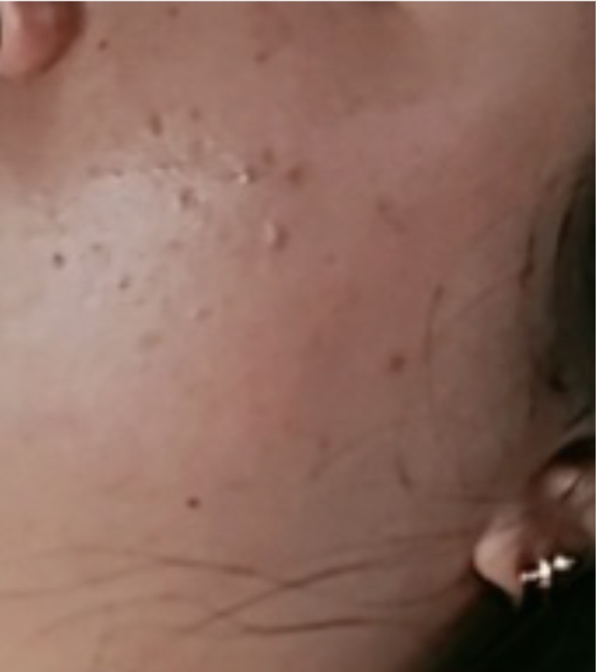 班吉原博士 Derma Relief 水蓝色胶囊精华素 common.review image