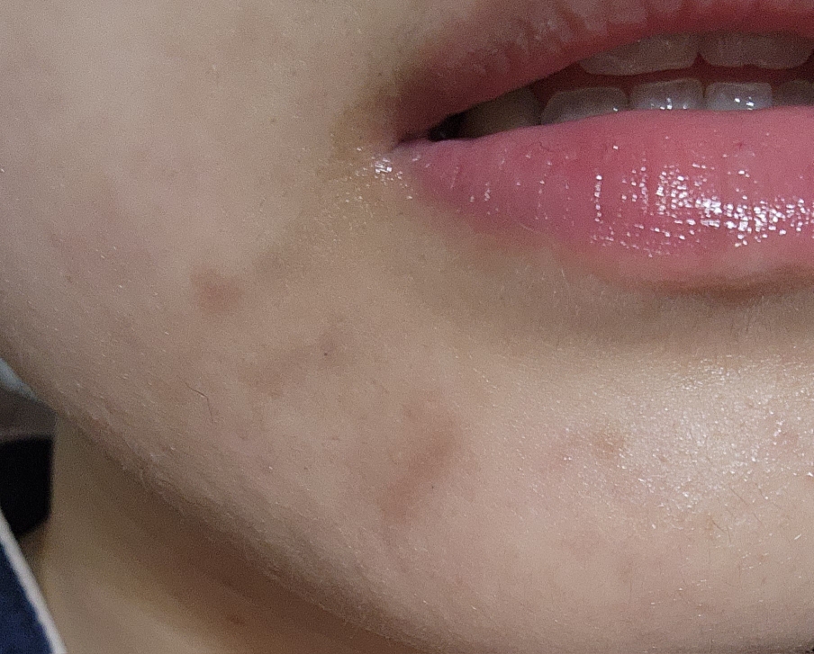 클라뷰 (KLAVUU) 리얼비건 비타민 앰플 review image