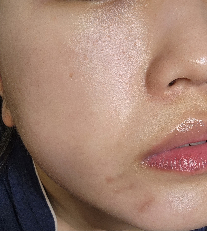 클라뷰 (KLAVUU) 리얼비건 비타민 앰플 review image