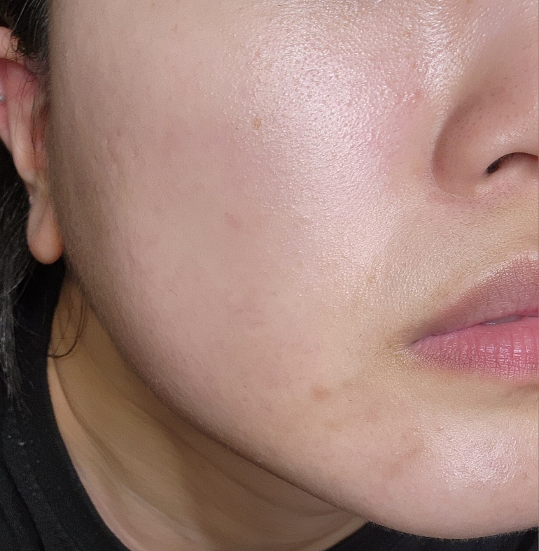 클라뷰 (KLAVUU) 리얼비건 비타민 앰플 review image