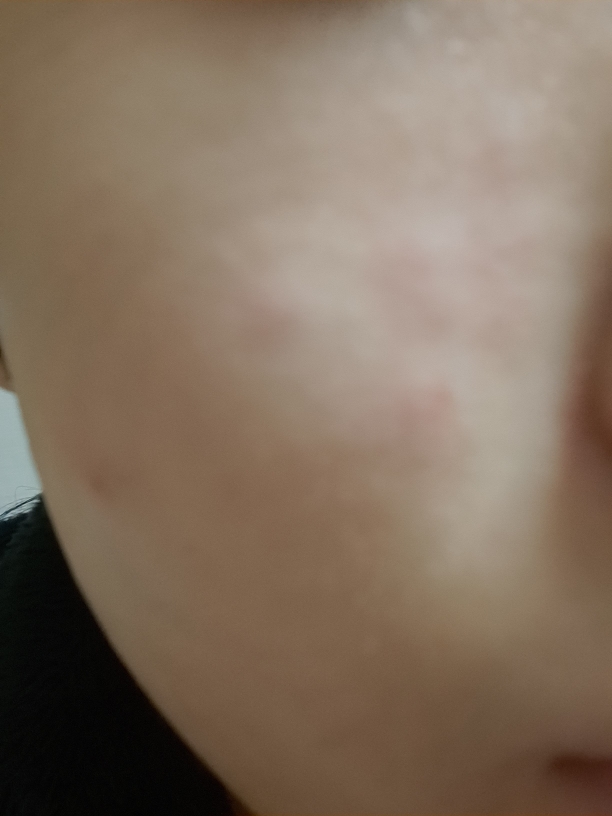 Real user review photo of SOON JUNG Moisture Lotion-Panthensoside™