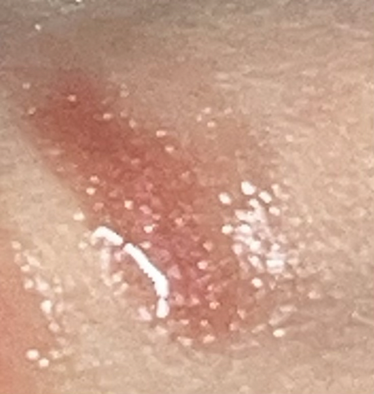 펜티뷰티 (FentyBeauty) (해외) 글로스밤 유니버셜 립 루미나이저 [FU$$Y] review image