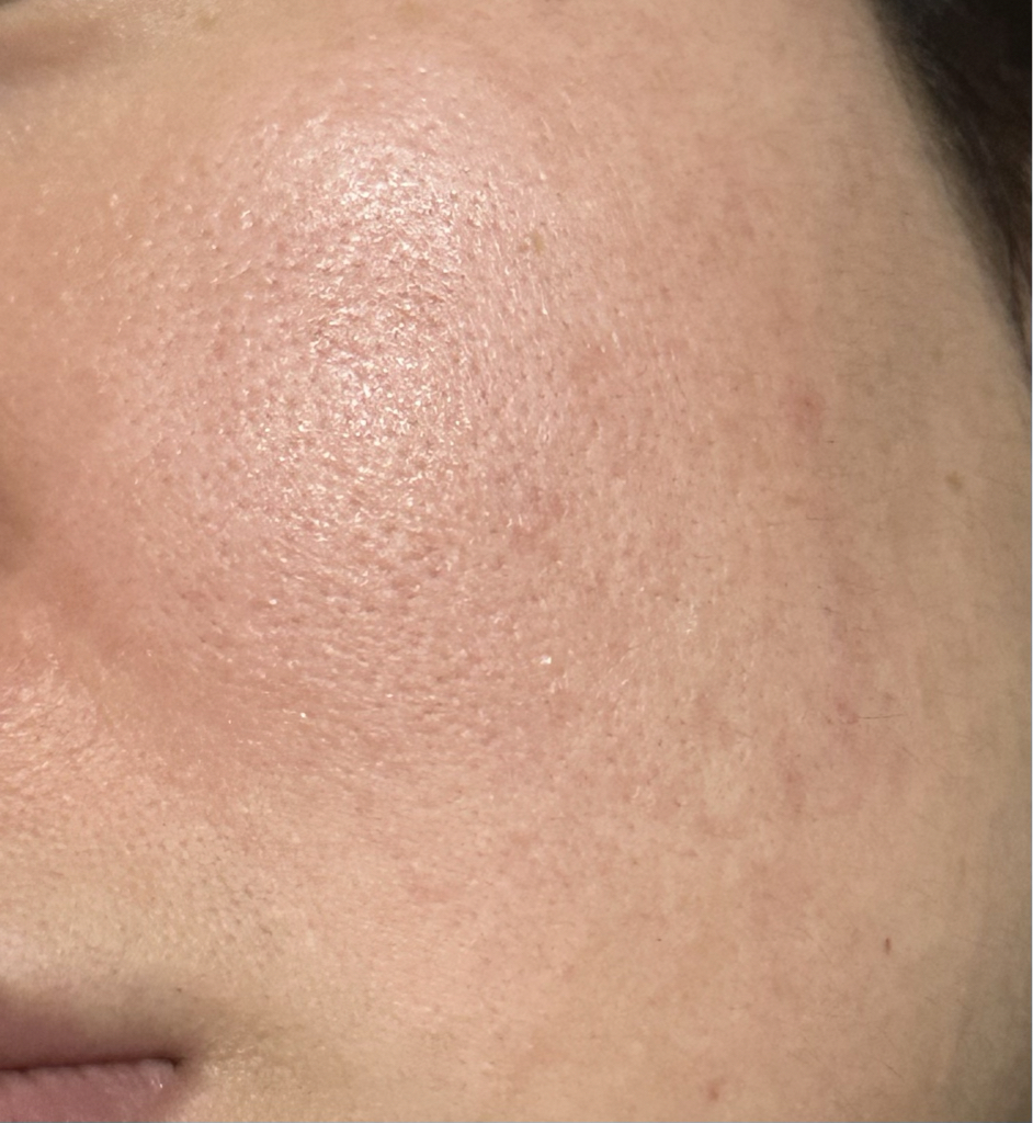 더마펌 (DERMAFIRM) 더 펩타이드 링클 세럼 review image