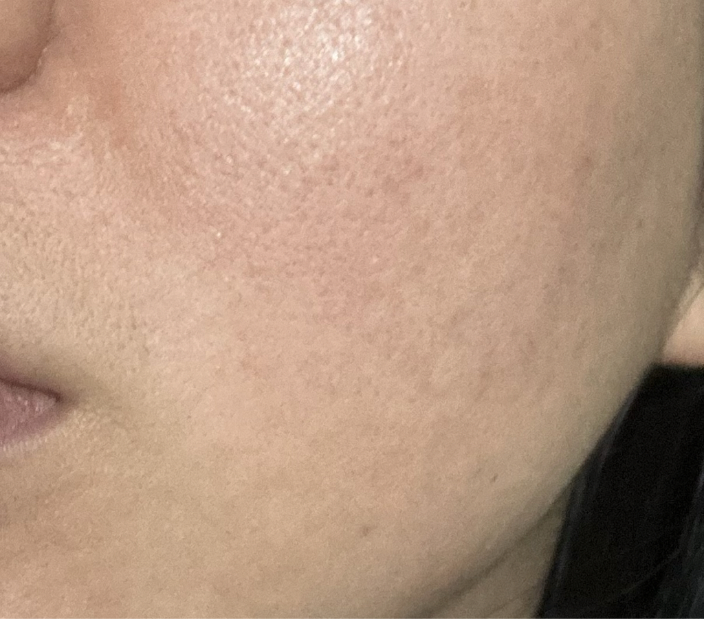 더마펌 (DERMAFIRM) 더 펩타이드 링클 세럼 review image