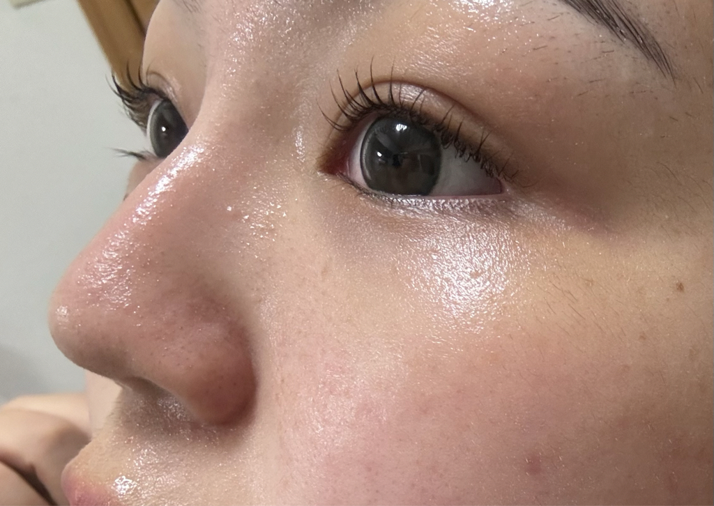 希恩派 红色蜂胶安瓿面膜 common.review image