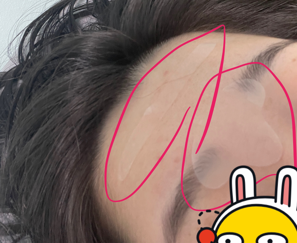 매드포코스 (MADFORCOS) 링클 마스터 패치 review image
