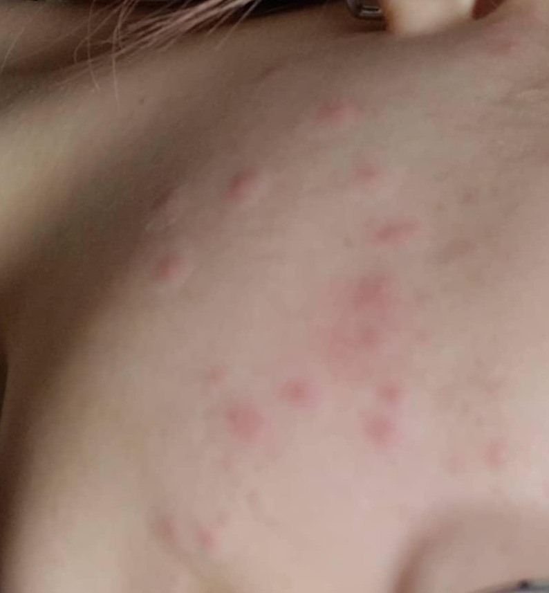 杰西诺博士强力凝胶 X6的真实用户使用照片