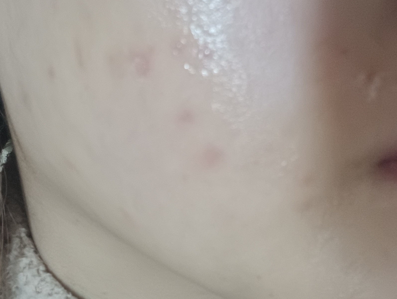 杰西诺博士强力凝胶 X6的真实用户使用照片