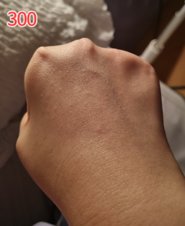 기타