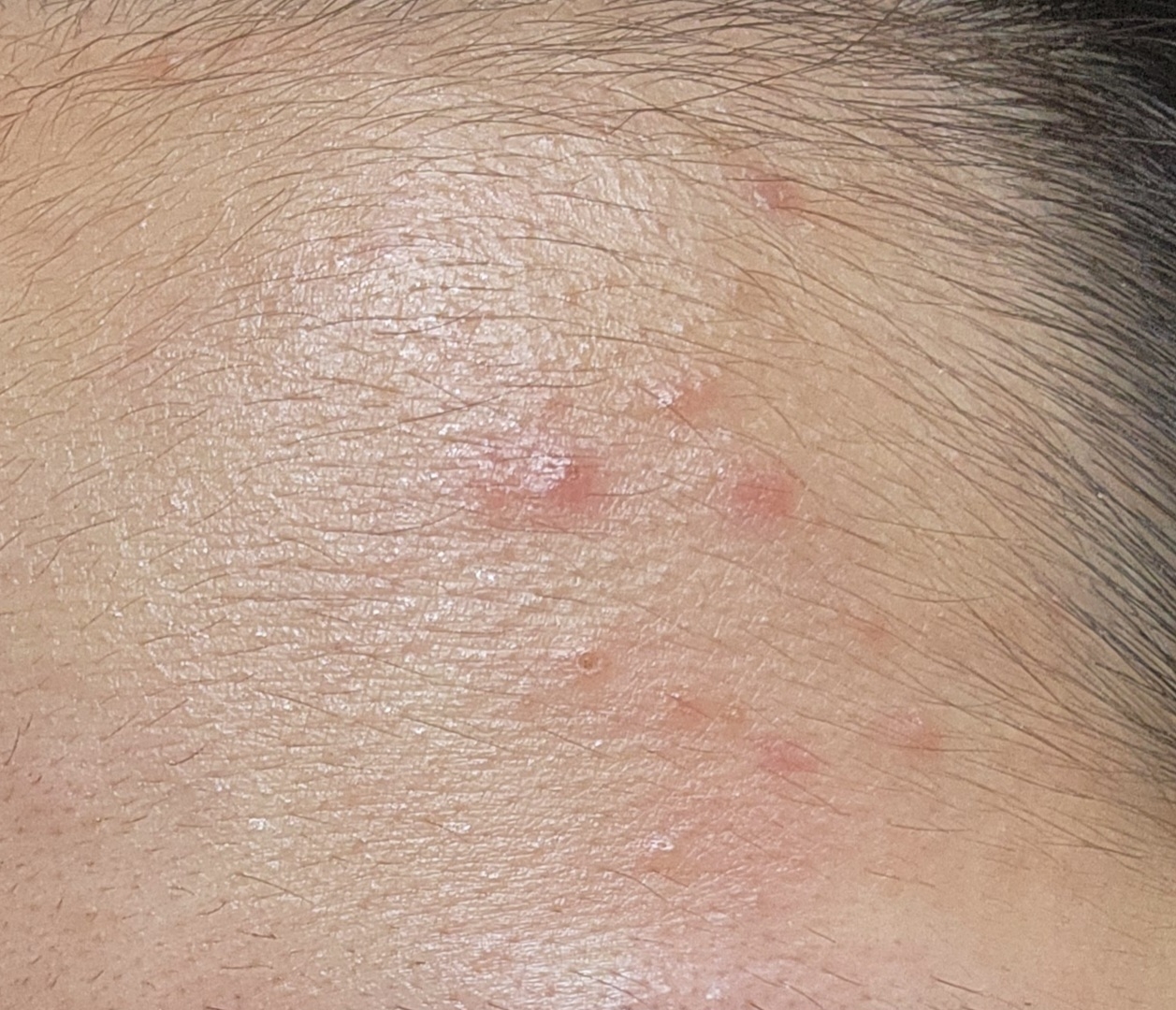 维他命C亮肤调理安瓶的真实用户使用照片