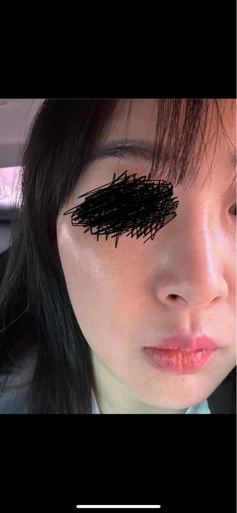 Real user review photo of PDRN Yeon-Uh Ampoule