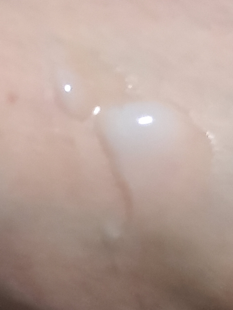 기타