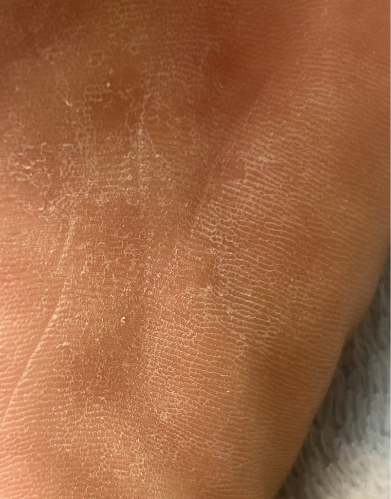 아트릭스 (atrix) 스트롱 카모마일 크림 review image