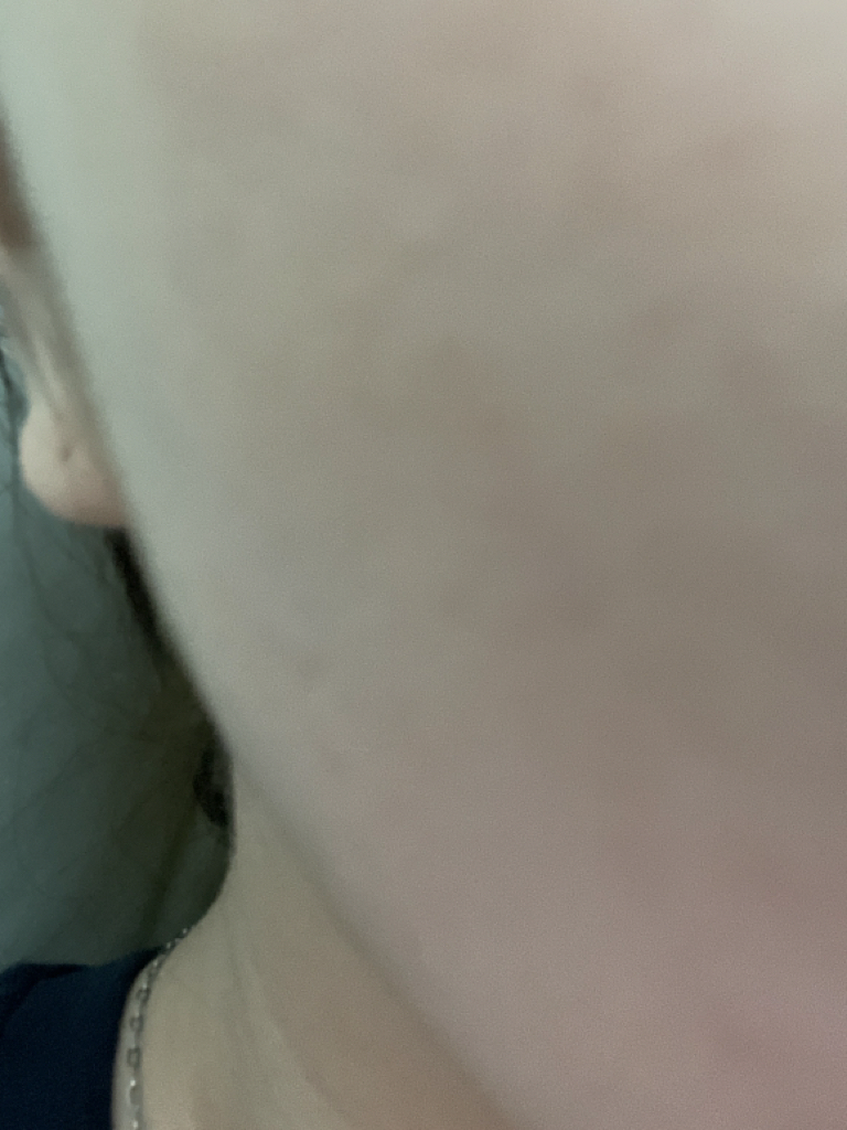茵陈蒿纯露的真实用户使用照片