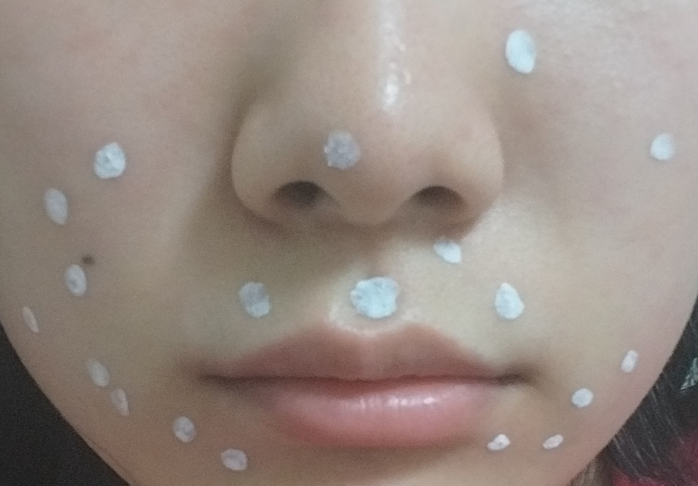 KiseraC SOS 集中护理 common.review image