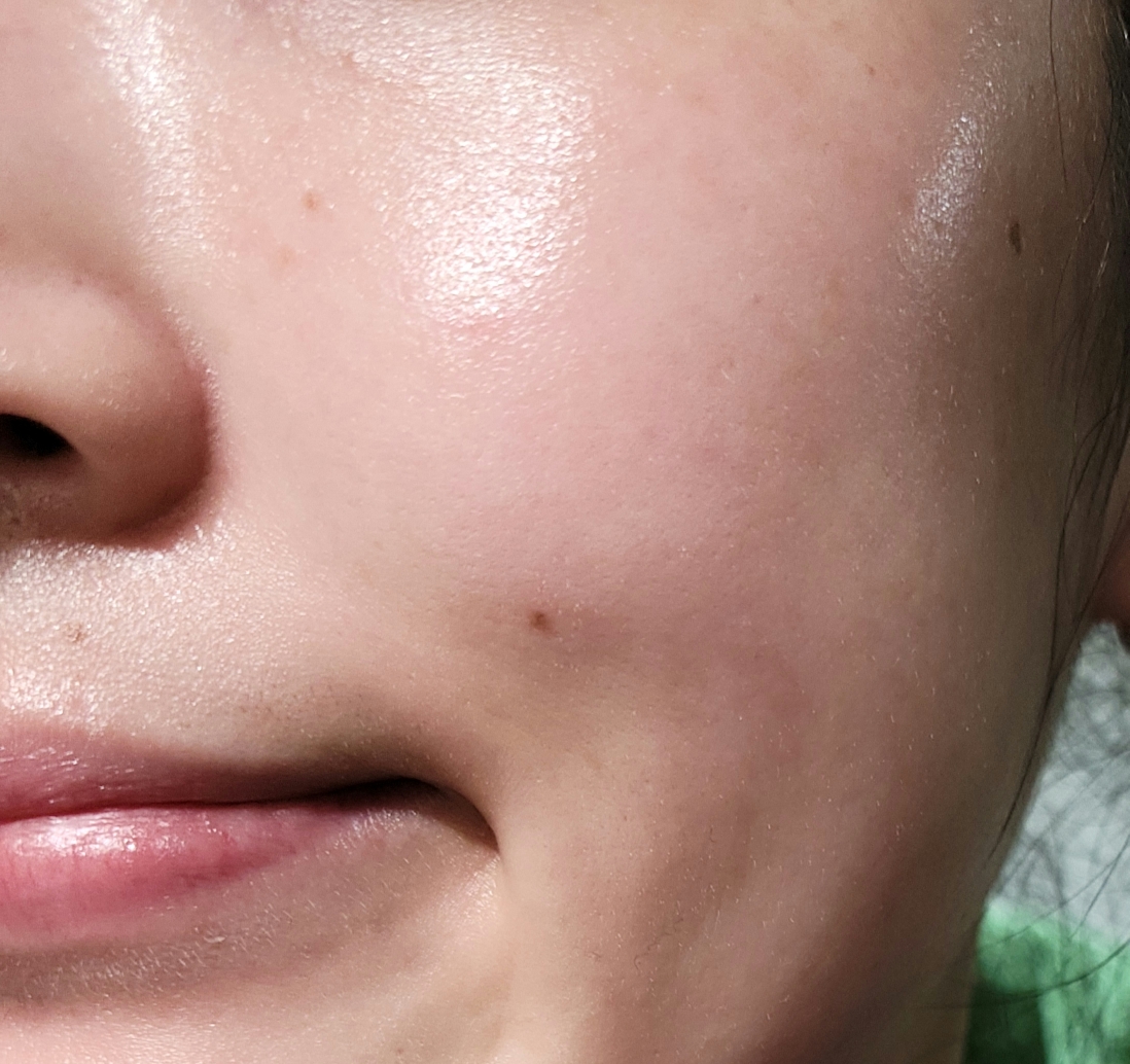메디앤서 (MediAnswer) 비타 콜라겐 로직 앰플 review image