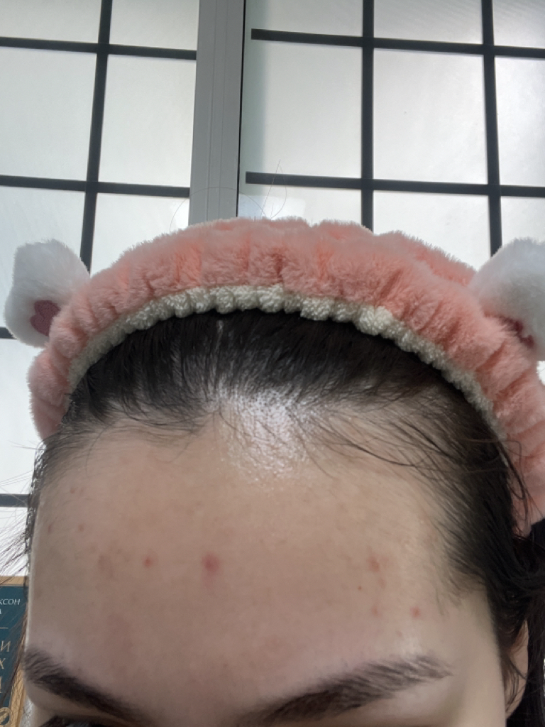 Real user review photo of HYPER NIACINAMIDE 20 SERUM