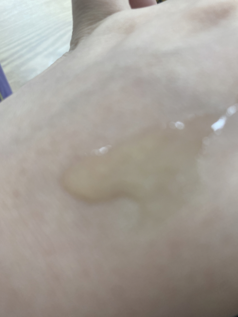 沙龙10专业级西卡玻尿酸精华油的真实用户使用照片