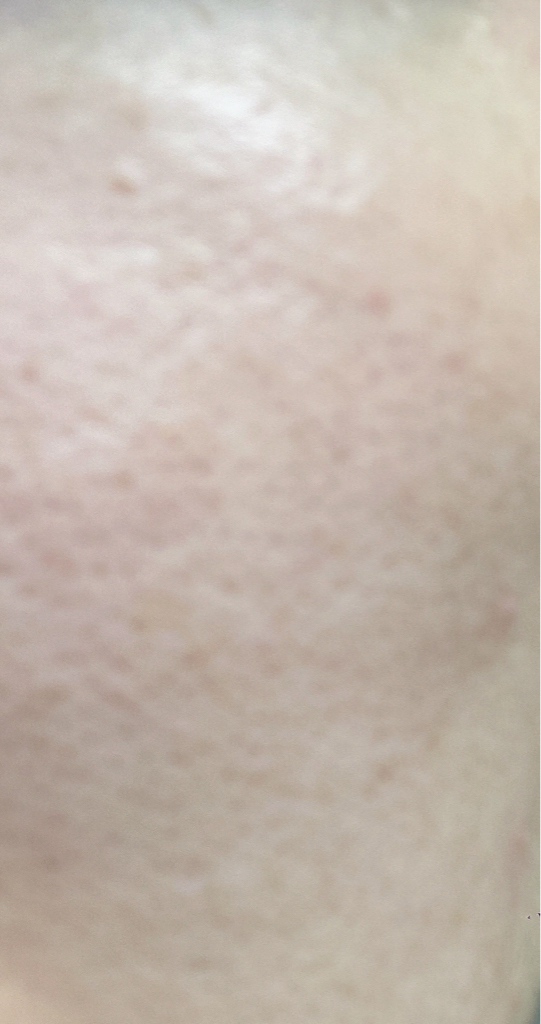 블리블리 (VELYVELY) 시카인진쑥 리페어 에센스 review image