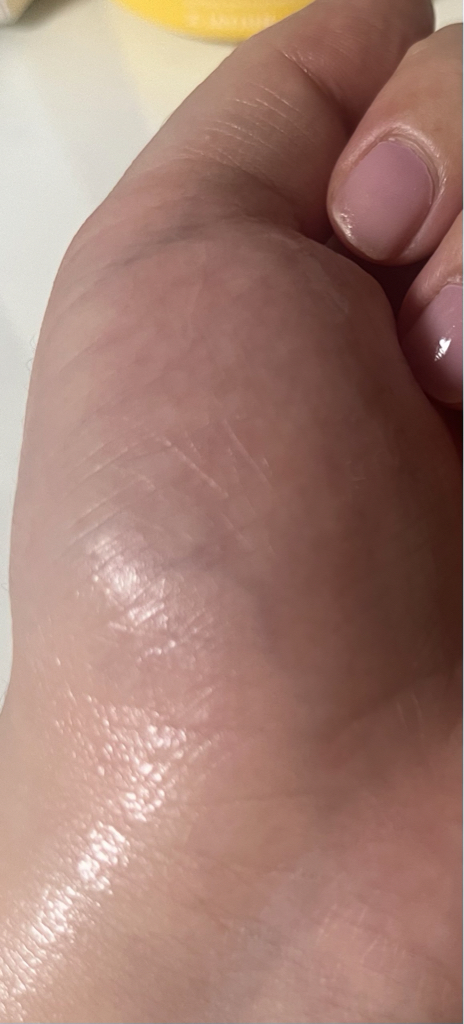 潜力平静乳霜爽肤水的真实用户使用照片