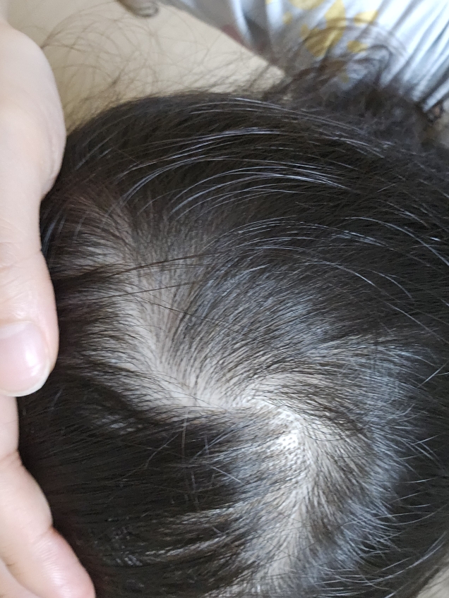 海草 莫里恩博士 common.review image