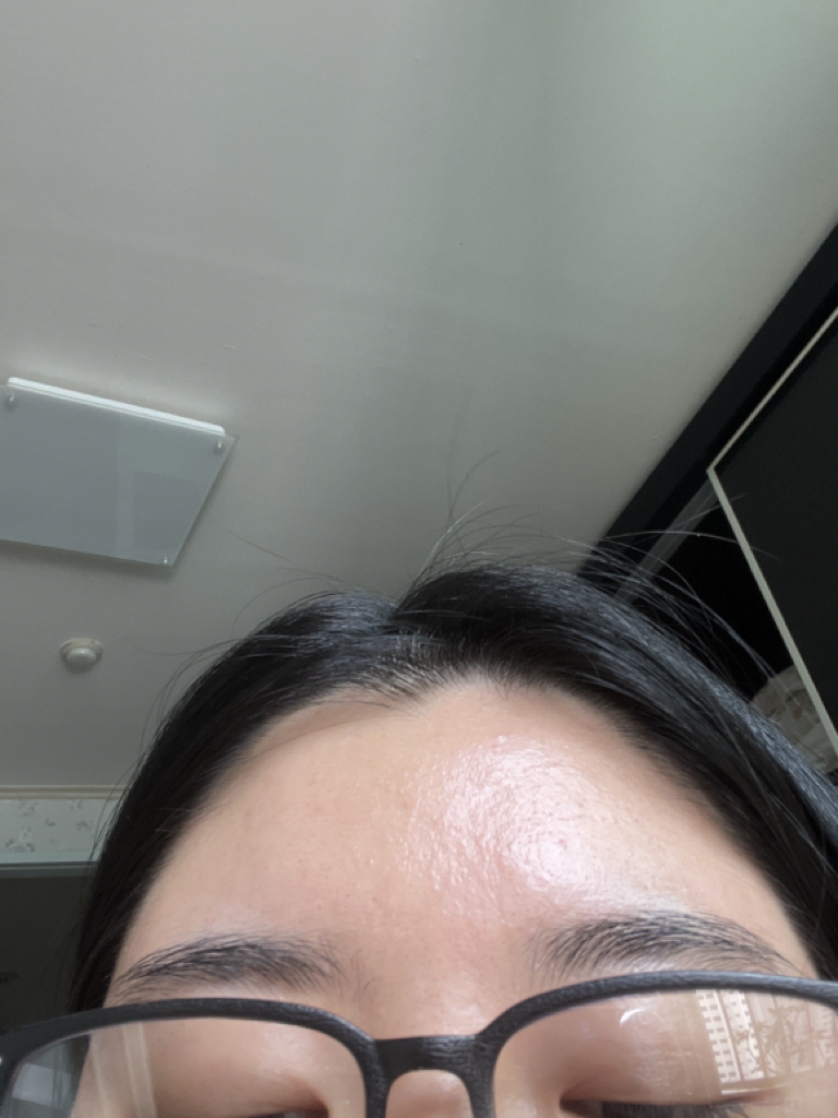 Real user review photo of ultra sensitive sun lotion [SPF50+/PA++++]