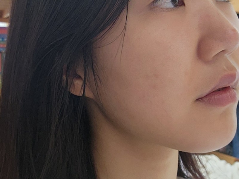 피디알엔 연어 앰플 review image