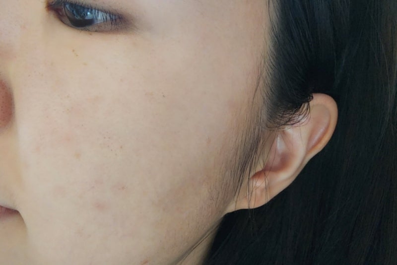 피디알엔 연어 앰플 review image