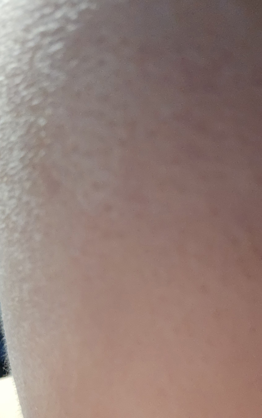 코코케어 (cococare) 100% 원액 오일 [티트리] review image