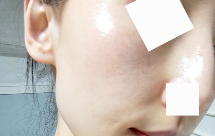 VTCOSMETICS PDRN Essence 100 review image
