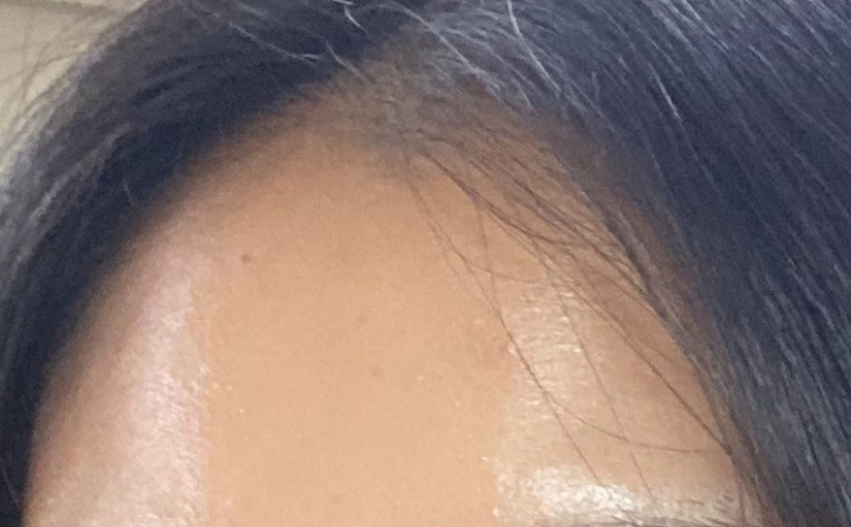 放射性重塑面部的真实用户使用照片