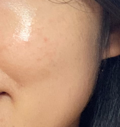放射性重塑面部的真实用户使用照片