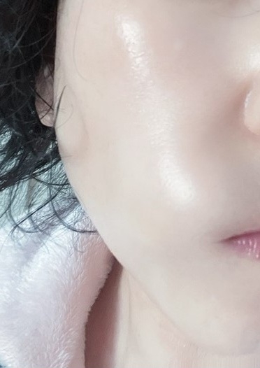 아마메르 (AMaMere) 4단계 미백앰플 review image