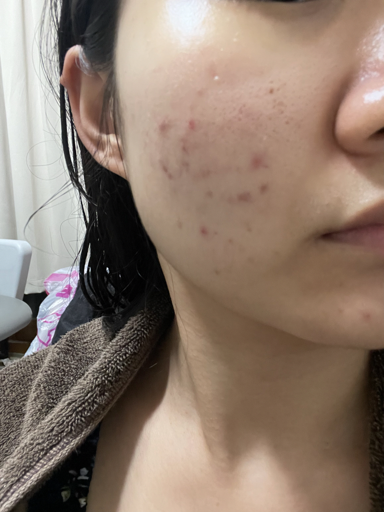 오방 (ovang) 바쿠치올 선인장 스킨 리페어 크림 review image