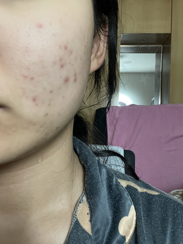 오방 (ovang) 바쿠치올 선인장 스킨 리페어 크림 review image