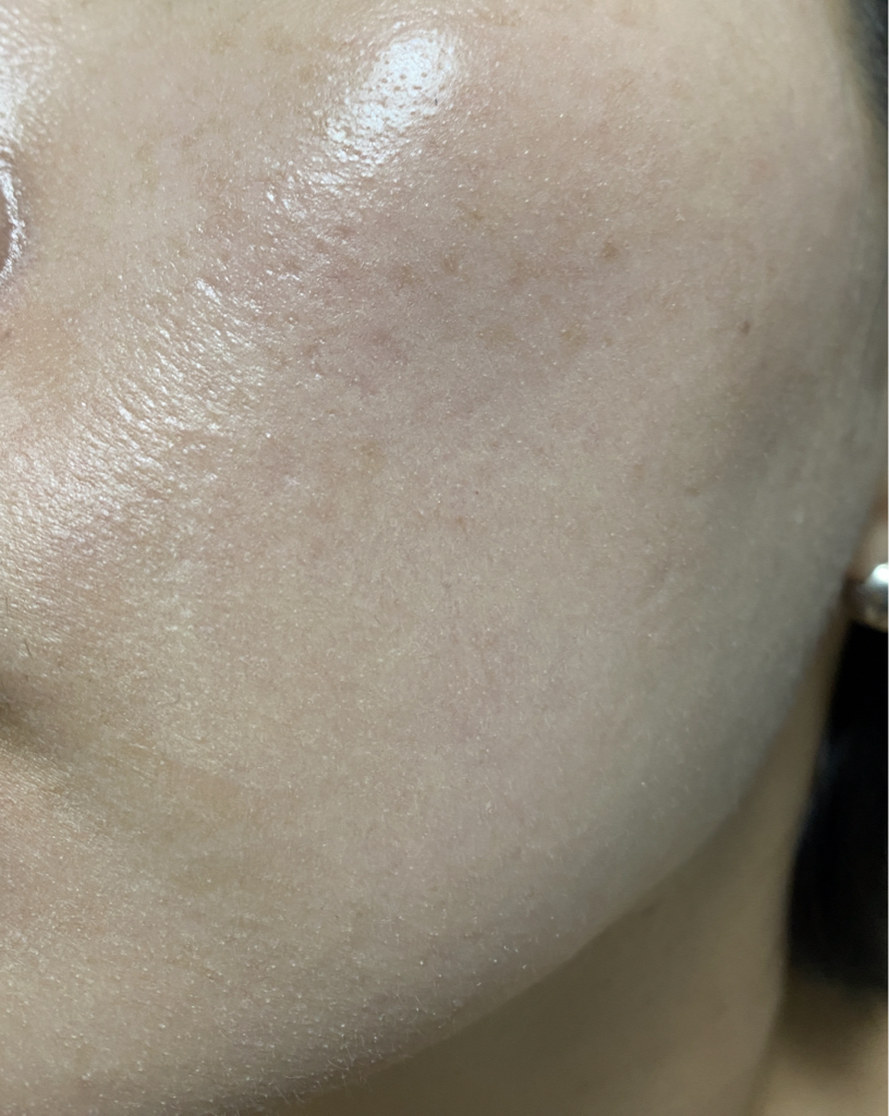 테라로직 (theralogic) 마데셀 더마 리페어 B5 선크림 [SPF50+/PA++++] review image