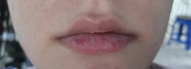 马吉 椰子滋养睡眠唇膜 review image