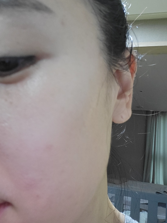 Real user review photo of Real Vitamin C Ampoule