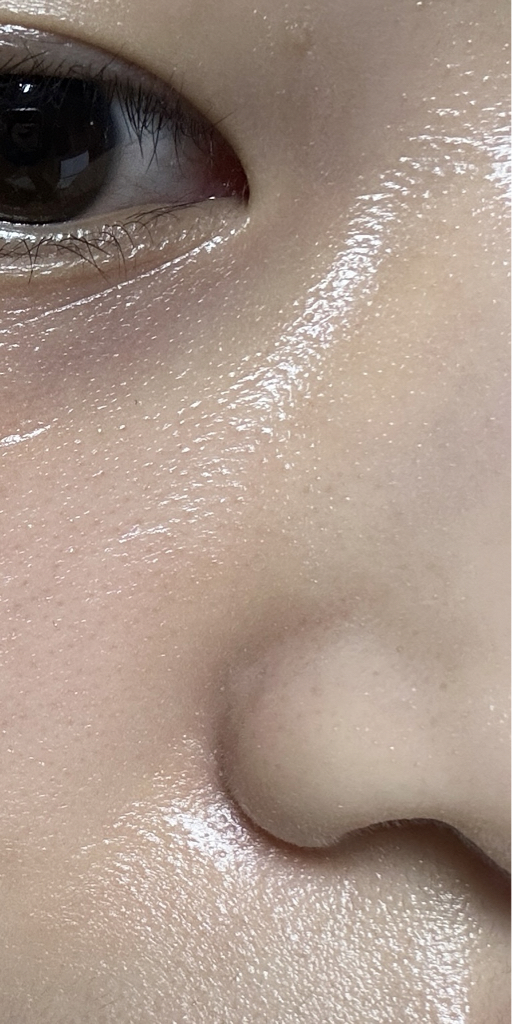 HOLITUAL 放射性重塑面部 common.review image