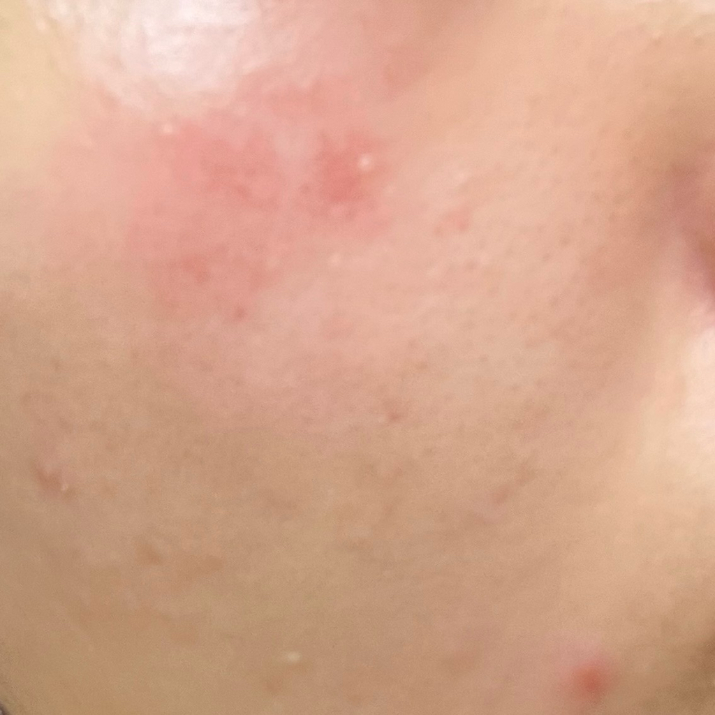 Real user review photo of D-PANTHENOL CREAM